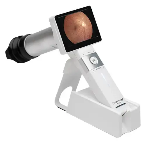 DEC200 Digital Ophthalmoscope Camera System