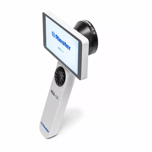 RCS-100 Digital Dermatoscope